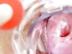 सोलो गंदी नर्स हो जाता है